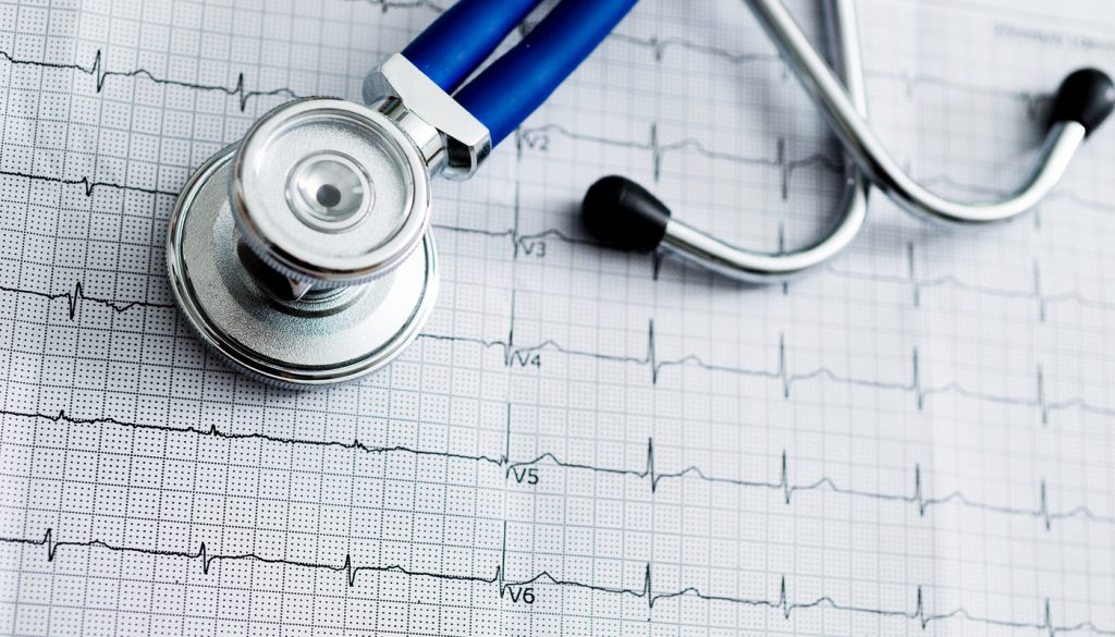 Close-up of a stethoscope on ECG printout.