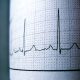 Sinus Heart Rhythm On Electrocardiogram