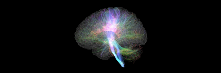 Colorful outline of brain on black background.